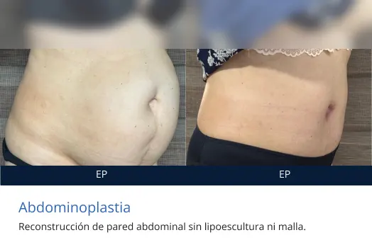 abdomino testimonial 2