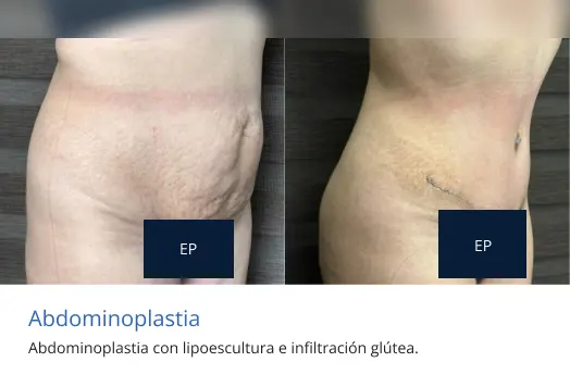 abdomino testimonial