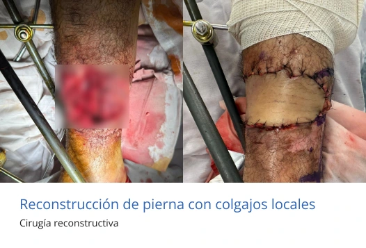 cirugia reconstructiva en morelia